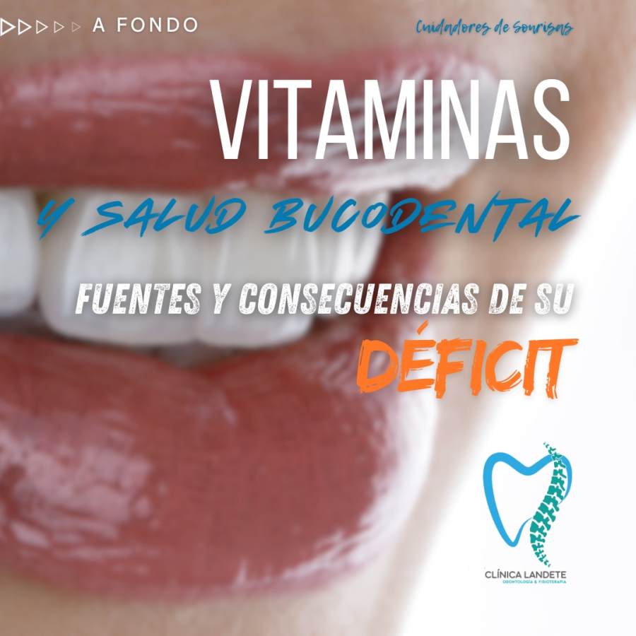 Vitaminas Esenciales para la Salud de Dientes y Encías